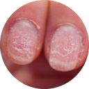 if your nails have been damaged